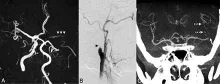 FIG 2.