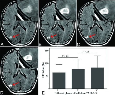 Fig 3.