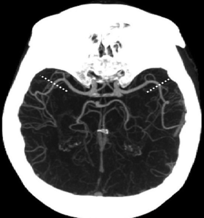 FIG 1.