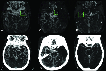 FIG 6.