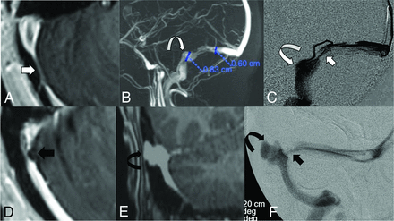 FIG 1.