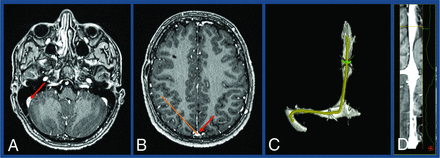 FIG 2.