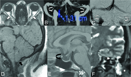 FIG 3.