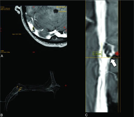 FIG 6.