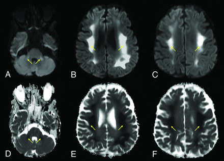 FIG 2.