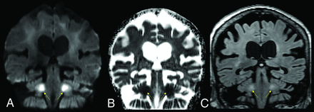 FIG 4.