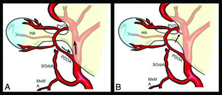 FIG 1.