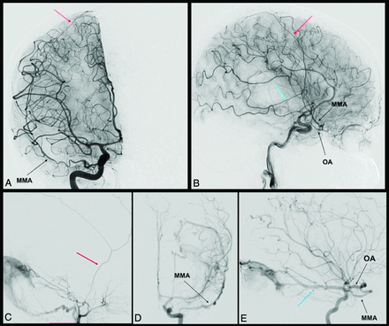 FIG 3.