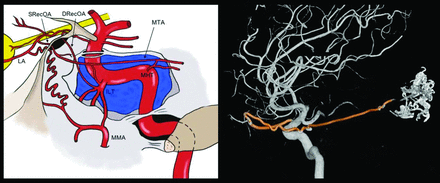 FIG 4.