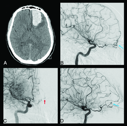 FIG 5.