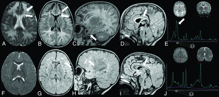 FIG 2.