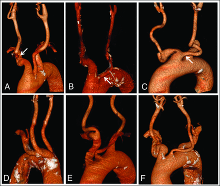 FIG 2.