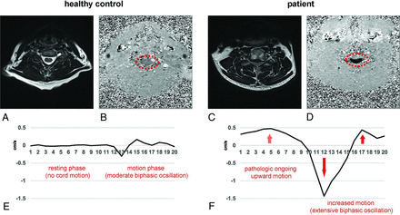 FIG 6.