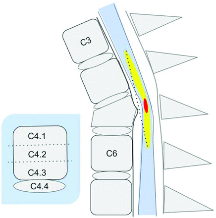 FIG 1.
