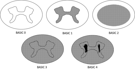 FIG 2.