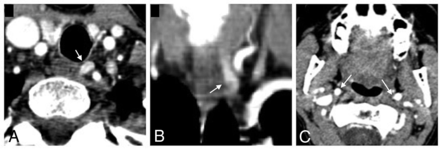 FIG 2.
