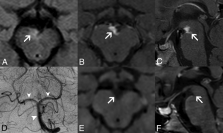 FIG 2.
