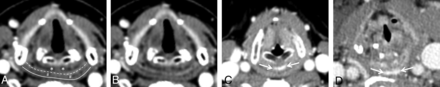 FIG 2.
