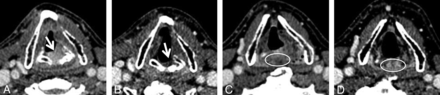 FIG 3.