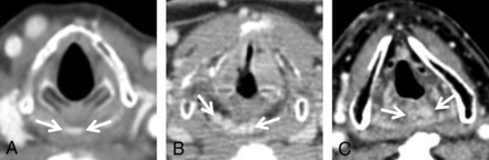FIG 4.