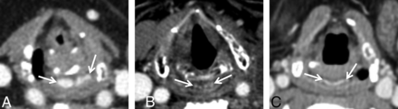 FIG 5.