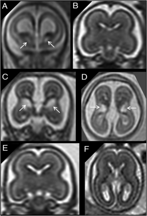 FIG 2.