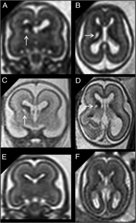 FIG 3.