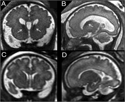 FIG 4.