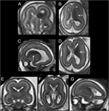 FIG 5.