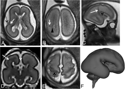 FIG 3.