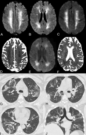 FIG 3.