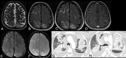 FIG 5.