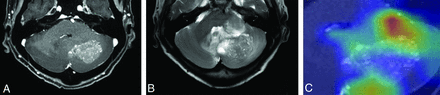 FIG 4.