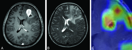FIG 5.