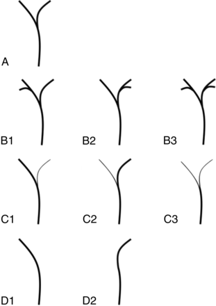FIG 1.