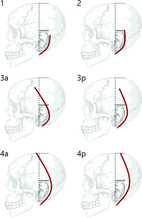 FIG 2.