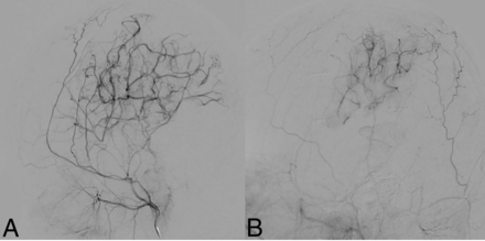 FIG 4.