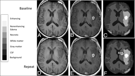 FIG 1.