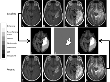 FIG 2.