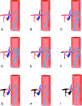 FIG 1.