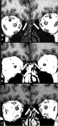 FIG 1.