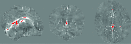 FIG 1.