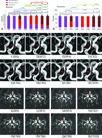 FIG 4.