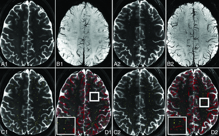 FIG 1.