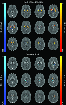 FIG 1.