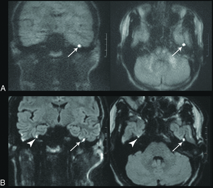 FIG 2.