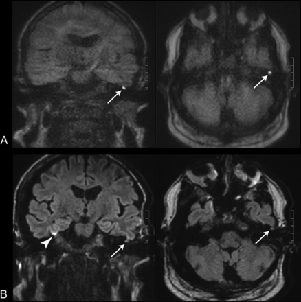 FIG 3.