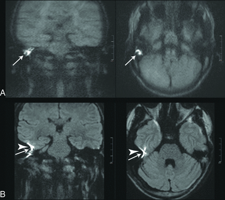 FIG 4.