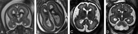 FIG 5.
