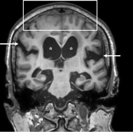 FIG 1.